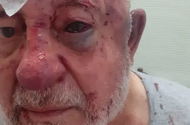 Konya'da 84 yaşındaki vakıf başkanına acımasız darp!